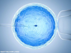 无精症案例